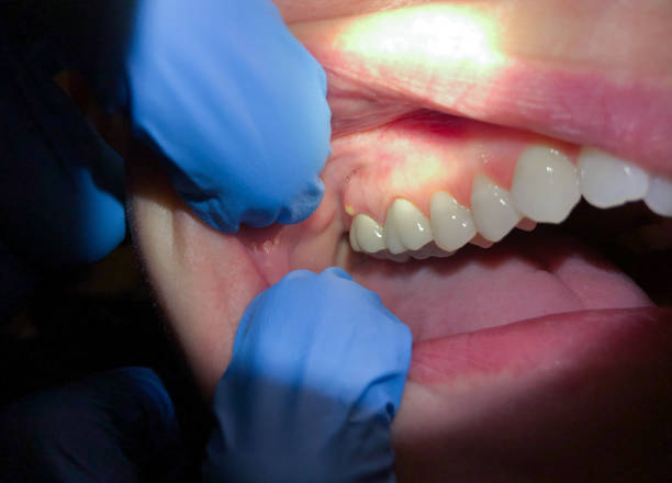 Best Dentist for Dental Trauma  in Pahokee, FL