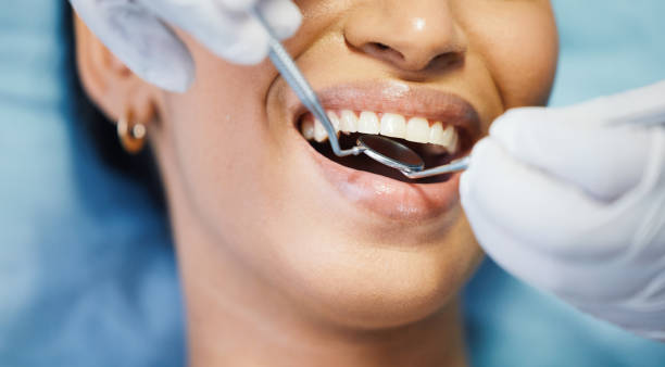 Best Dentist for Tooth Abscess  in Pahokee, FL