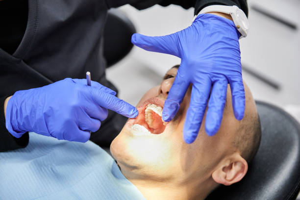 Best Cracked Tooth Emergency Dentist  in Pahokee, FL